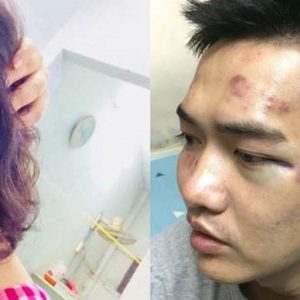 Musiker und Besucher eines Musikevents in Vietnam von der Polizei angegriffen und schwer misshandelt