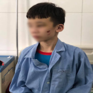 Việt Nam: Chủ bạo hành – Trẻ em bị ăn „chày đập đá”